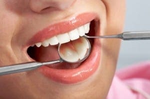 Dental Instruments and tools Tools used by Dr Miller, Arlington Texas Dentist