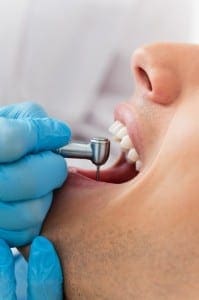 Drill Dentist